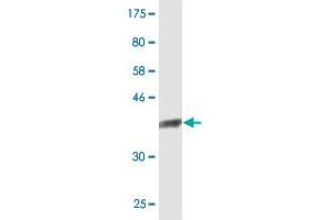 Western Blot detection against Immunogen (36. (NDOR1 anticorps  (AA 498-595))