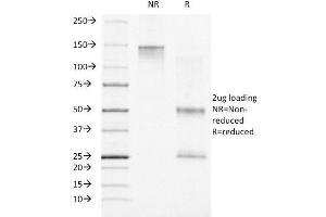 SDS-PAGE Analysis Purified Progesterone Receptor Mouse Monoclonal Antibody (PR500). (Progesterone Receptor anticorps)