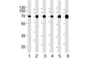Acetylcholinesterase antibody western blot analysis in 1) human Raji, 2) human Jurkat, 3) human COS7, 4) mouse NIH3T3, 5) mouse cerebellum, and 6) rat cerebellum lysate. (Acetylcholinesterase anticorps  (AA 587-611))