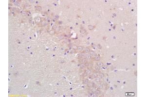 Formalin-fixed and paraffin embedded rat brain labeled with Rabbit Anti CYP19/CYP19A1 Polyclonal Antibody, Unconjugated (ABIN674529) at 1:200 followed by conjugation to the secondary antibody and DAB staining (Aromatase anticorps  (AA 41-140))