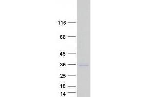 Validation with Western Blot