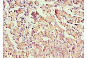 Immunohistochemistry of paraffin-embedded human pancreatic tissue using ABIN7155744 at dilution of 1:100 (HOXB7 anticorps  (AA 1-120))