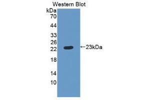 Western blot analysis of recombinant Human RBP4. (RBP4 anticorps  (AA 18-201))