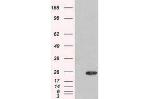 Image no. 1 for anti-Adenylate Kinase 1 (AK1) antibody (ABIN1496515) (Adenylate Kinase 1 anticorps)