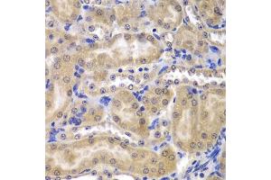 Immunohistochemistry of paraffin-embedded mouse kidney using RPL5 antibody (ABIN3015785, ABIN3015786, ABIN3015787 and ABIN6219135) at dilution of 1:200 (40x lens). (RPL5 anticorps  (AA 1-95))