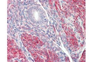 Anti-LMOD1 antibody IHC staining of human uterus.