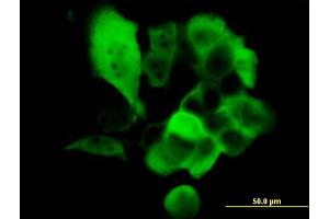 Immunofluorescence of monoclonal antibody to S100A2 on A-431 cell.