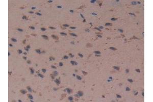 Detection of Cys-C in Mouse Cerebrum Tissue using Polyclonal Antibody to Cystatin C (Cys-C) (CST3 anticorps  (AA 21-140))
