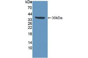 Western blot analysis of recombinant Human VCP. (VCP anticorps  (AA 125-371))