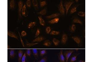Immunofluorescence analysis of U-2 OS cells using RGS4 Polyclonal Antibody at dilution of 1:100.