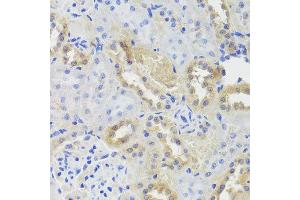 Immunohistochemistry of paraffin-embedded rat kidney using CTSC antibody at dilution of 1:100 (x40 lens). (CTSC anticorps)