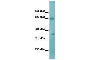 WB Suggested Anti-KHK Antibody Titration:  0. (Ketohexokinase anticorps  (N-Term))