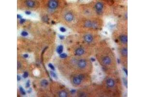 Used in DAB staining on fromalin fixed paraffin-embedded Liver tissue (IFNA21 anticorps  (AA 25-189))