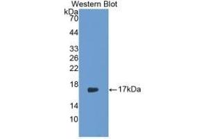 Detection of Recombinant IL17, Rabbit using Monoclonal Antibody to Interleukin 17 (IL17)