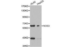 Western blot analysis of extracts of HL60 and HepG2 cell lines, using NOS3 antibody. (ENOS anticorps)