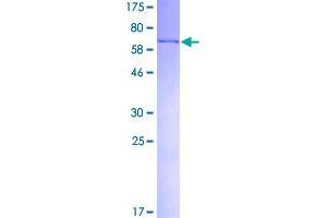 Image no. 1 for Flap Structure-Specific Endonuclease 1 (FEN1) (AA 1-380) protein (GST tag) (ABIN1353954)