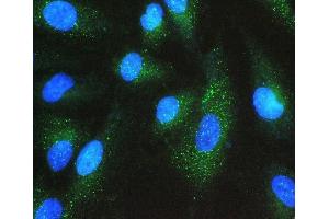 IF analysis of GNB1 using anti-GNB1 antibody (ABIN4886607).