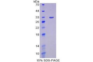 SDS-PAGE (SDS) image for Protein Tyrosine Phosphatase Receptor Type K (PTPRK) (AA 1185-1440) protein (His tag) (ABIN2126552)