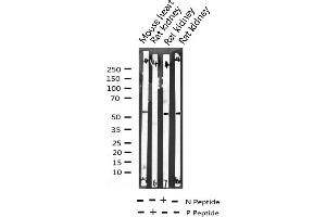 Western blot analysis of Phospho-ATF2 (Ser112 or 94) expression in various lysates (ATF2 anticorps  (pSer94, pSer112))