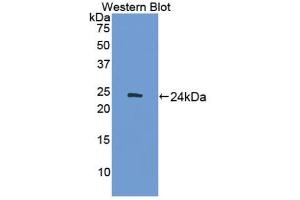 Western blot analysis of the recombinant protein. (ADCY7 anticorps  (AA 309-491))