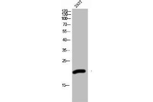 Western Blot analysis of 293T cells using ZNF695 Polyclonal Antibody (ZNF695 anticorps  (Internal Region))