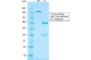 SDS-PAGE Analysis of Purified WT1 Mouse Recombinant Monoclonal Antibody ABIN6383829. (Recombinant WT1 anticorps)