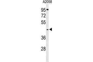 Western Blotting (WB) image for anti-Trans-2,3-Enoyl-CoA Reductase (TECR) antibody (ABIN3004322) (TECR anticorps)