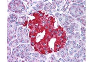 Immunohistochemistry with pFA fixed human pancreas tissue tissue
