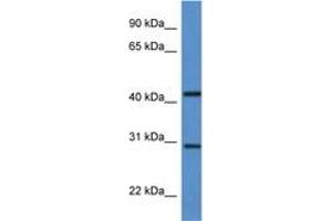 Image no. 1 for anti-Alkaline Ceramidase 1 (ACER1) (C-Term) antibody (ABIN6746914) (ACER1 anticorps  (C-Term))