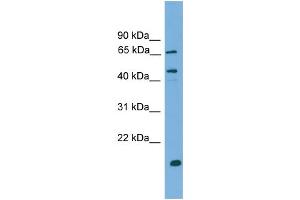 WB Suggested Anti-DNAJA2 Antibody Titration: 0. (DNAJA2 anticorps  (N-Term))