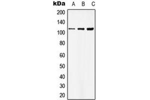 Western blot analysis of Basonuclin expression in HKE293T (A), Raw264. (Basonuclin (N-Term) anticorps)