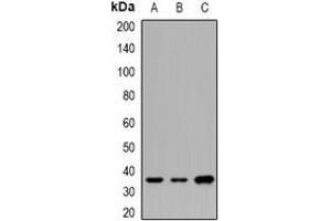 Western blot analysis of CNTFR alpha expression in SW620 (A), BT474 (B), mouse brain (C) whole cell lysates.