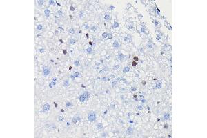 Immunohistochemistry of paraffin-embedded mouse liver using [KO Validated] Cyclin D1 Rabbit mAb (ABIN7266561) at dilution of 1:100 (40x lens).