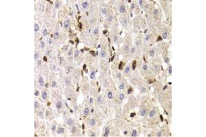Immunohistochemistry of paraffin-embedded human liver injury using SPN antibody. (CD43 anticorps  (AA 276-400))