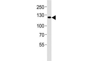 Western blot analysis of lysate from LNCaP cell line using JAK2 antibody diluted at 1:1000.