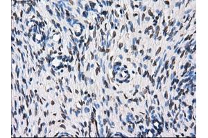 Immunohistochemical staining of paraffin-embedded Kidney tissue using anti-TTLL12mouse monoclonal antibody. (TTLL12 anticorps)