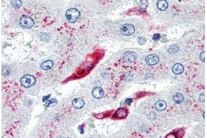 Human Liver, Kupffer Cells (formalin-fixed, paraffin-embedded) stained with CD74 antibody ABIN239807 at 10 µg/ml followed by biotinylated anti-mouse IgG secondary antibody ABIN481714, alkaline phosphatase-streptavidin and chromogen. (CD74 anticorps)