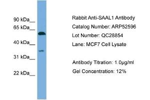 WB Suggested Anti-SAAL1  Antibody Titration: 0. (SAAL1 anticorps  (N-Term))
