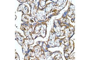 Immunohistochemistry of paraffin-embedded human placenta using Folate Binding Protein(FBP) / FOLR1 Rabbit mAb (ABIN7267223) at dilution of 1:100 (40x lens).