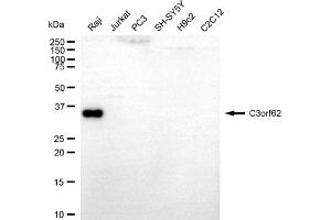 anti-Chromosome 3 Open Reading Frame 62 (C3orf62) antibody