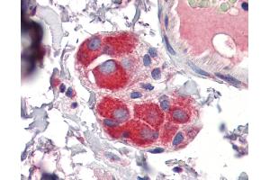 IHC Information: Paraffin embedded small intestine, submucosal plexus tissue, tested with an antibody dilution of 5 ug/ml.
