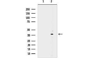 Western blot analysis of lysates from PC12 cells(heat shock treatment), using CEACAM6 Antibody.