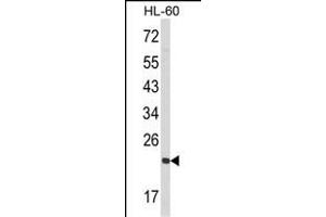 Western blot analysis of RAN Antibody (N-term) (ABIN390647 and ABIN2840945) in HL-60 cell line lysates (35 μg/lane). (RAN anticorps  (N-Term))