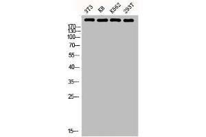 Western blot analysis of 3T3 KB K562 293T lysis using FN1 antibody.