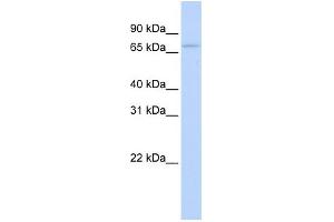 WB Suggested Anti-RBM35B Antibody Titration:  0. (ESRP2 anticorps  (N-Term))
