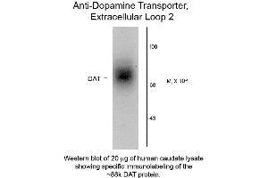 Western Blot of Anti-Dopamine Transporter (Rabbit) Antibody - 600-401-D30 Western Blot of Rabbit Anti-Dopamine Transporter C-Terminus Human Antibody.