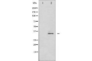 Western blot analysis of CDK2 phosphorylation expression in A2780 whole cell lysates,The lane on the left is treated with the antigen-specific peptide.