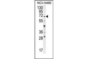 Western blot analysis of FUT4 Antibody (C-term) in NCI-H460 cell line lysates (35ug/lane). (CD15 anticorps  (C-Term))