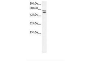 Image no. 1 for anti-Zinc Finger Protein 768 (ZNF768) (AA 57-106) antibody (ABIN202709) (ZNF768 anticorps  (AA 57-106))