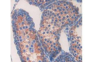 Used in DAB staining on fromalin fixed paraffin- embedded testis tissue